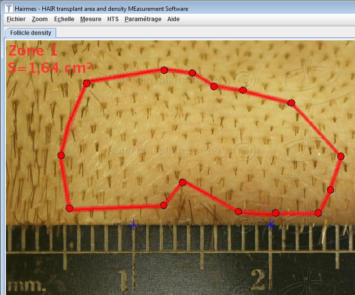 Tracing the contour of the measurement zone
