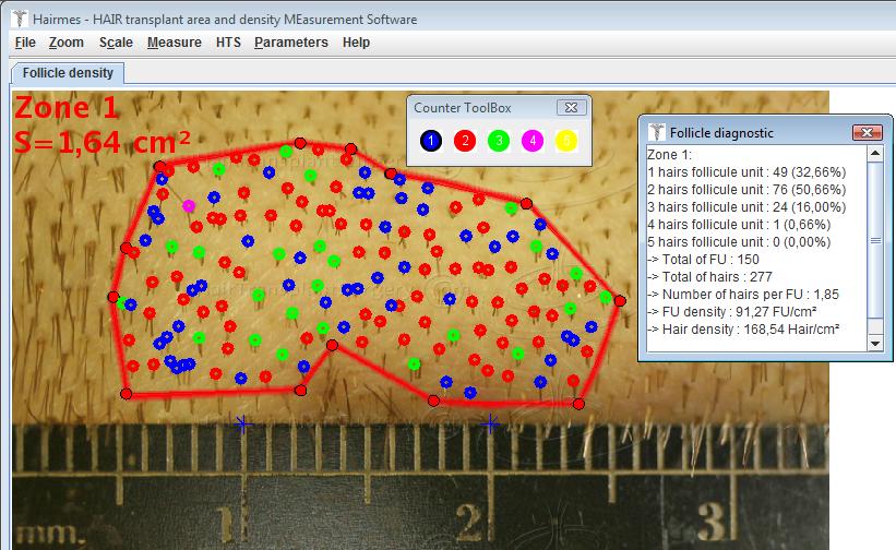Marking and identifying follicles